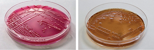 Macconkey Agar E Coli