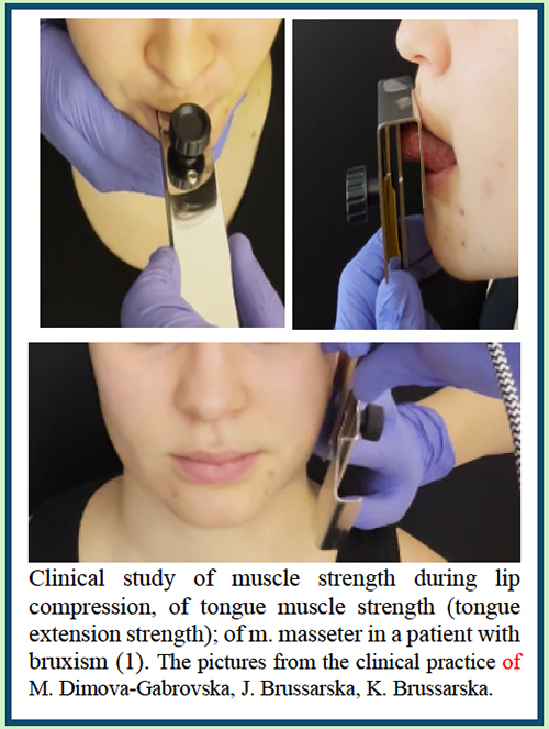 Abs105.jpg